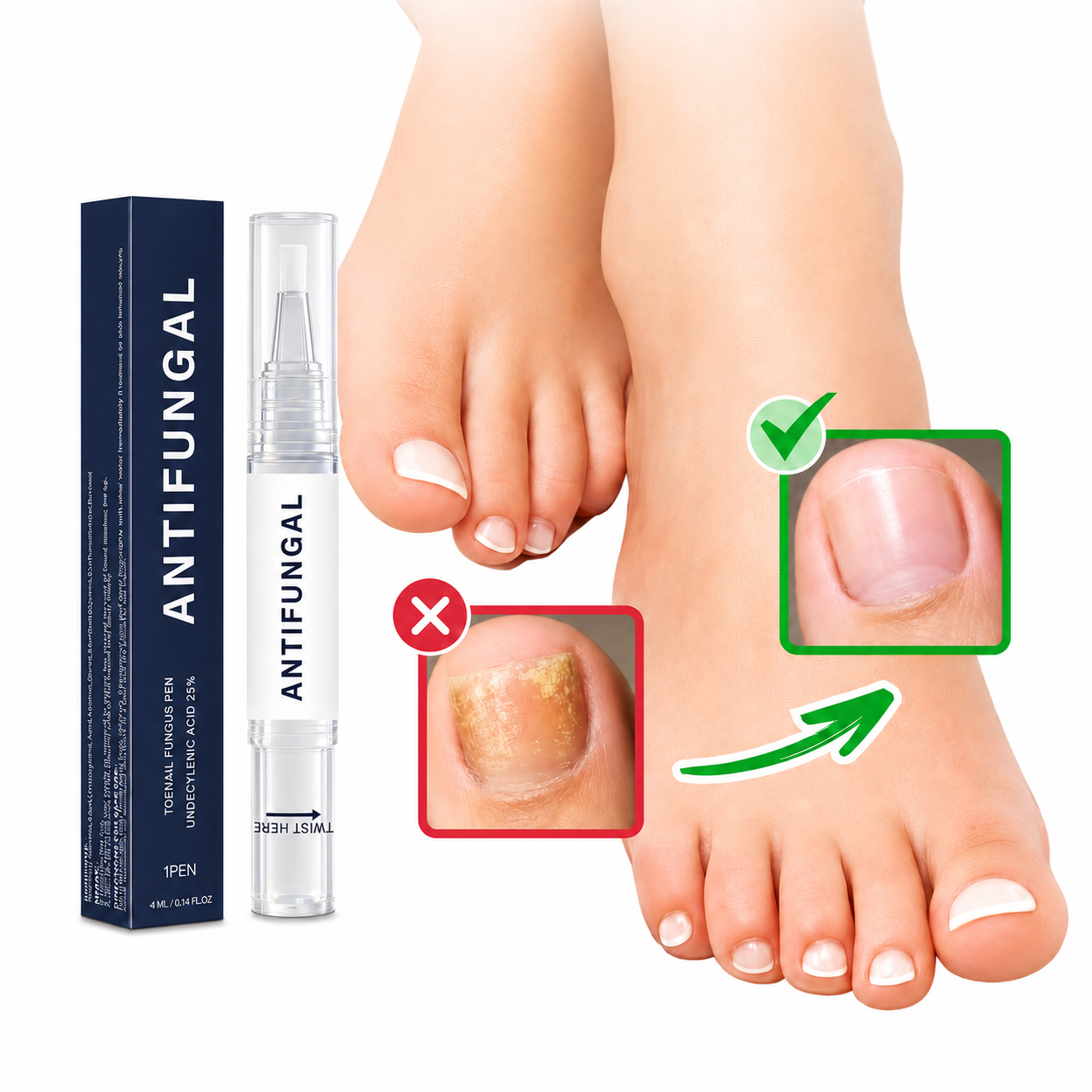 BetterSkin™ Lápiz Anti Hongos